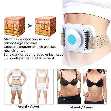 Appareil de cryolipolyse