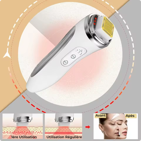 Skin care device with before and after effects on a beige background