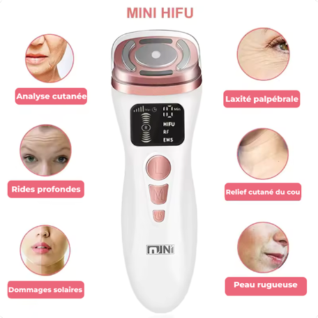 Mini HIFU device with skin improvement effects on a white background