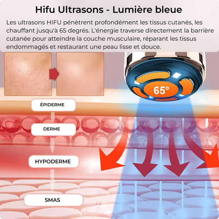 hifu-ultrasons-lumiere-blue