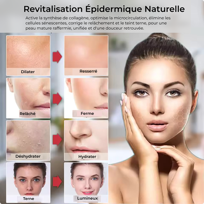 Appareil RF pour visage